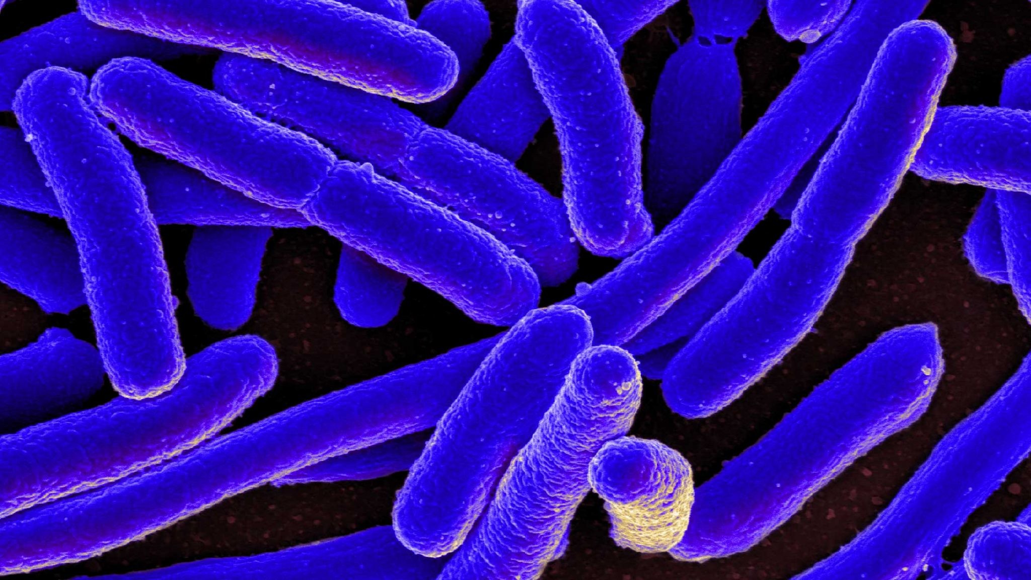 2048x1152 e-coli-sem
