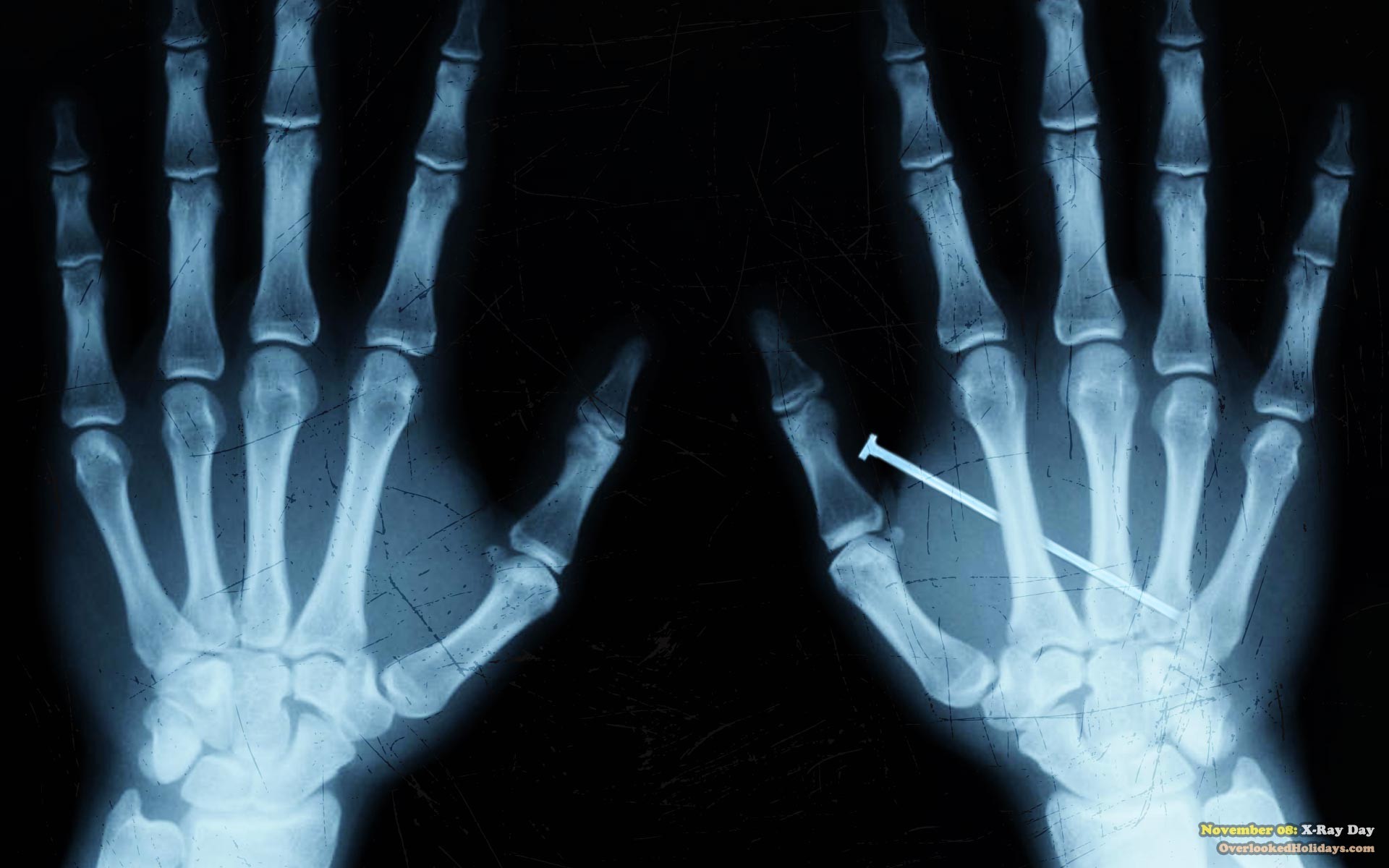 1920x1200 0 2560x1600 Wallpapers | Xray Vision  Wallpapers X Ray Bone Middle  Finger On Line 2560x1920 #164423 #x ray