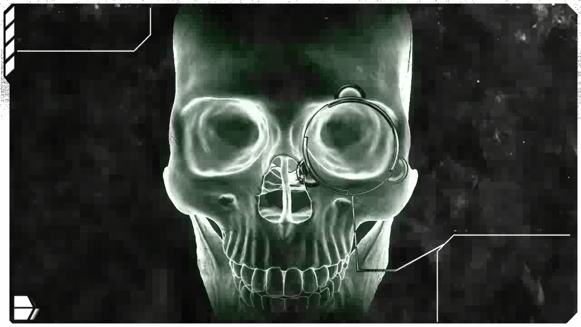 1920x1080  Human Skull X Ray Wallpaper
